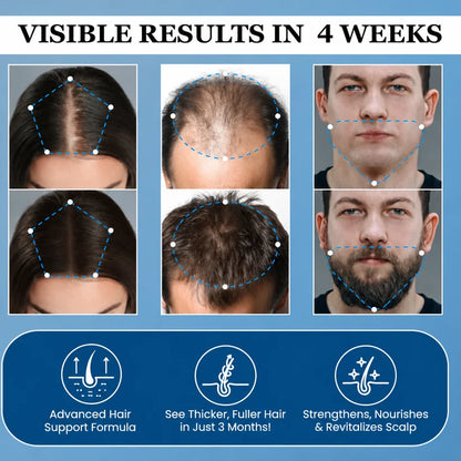 Hair Growth Roll-On Serum — Combat Thinning & Promote Thicker, Fuller Hair（Discount）