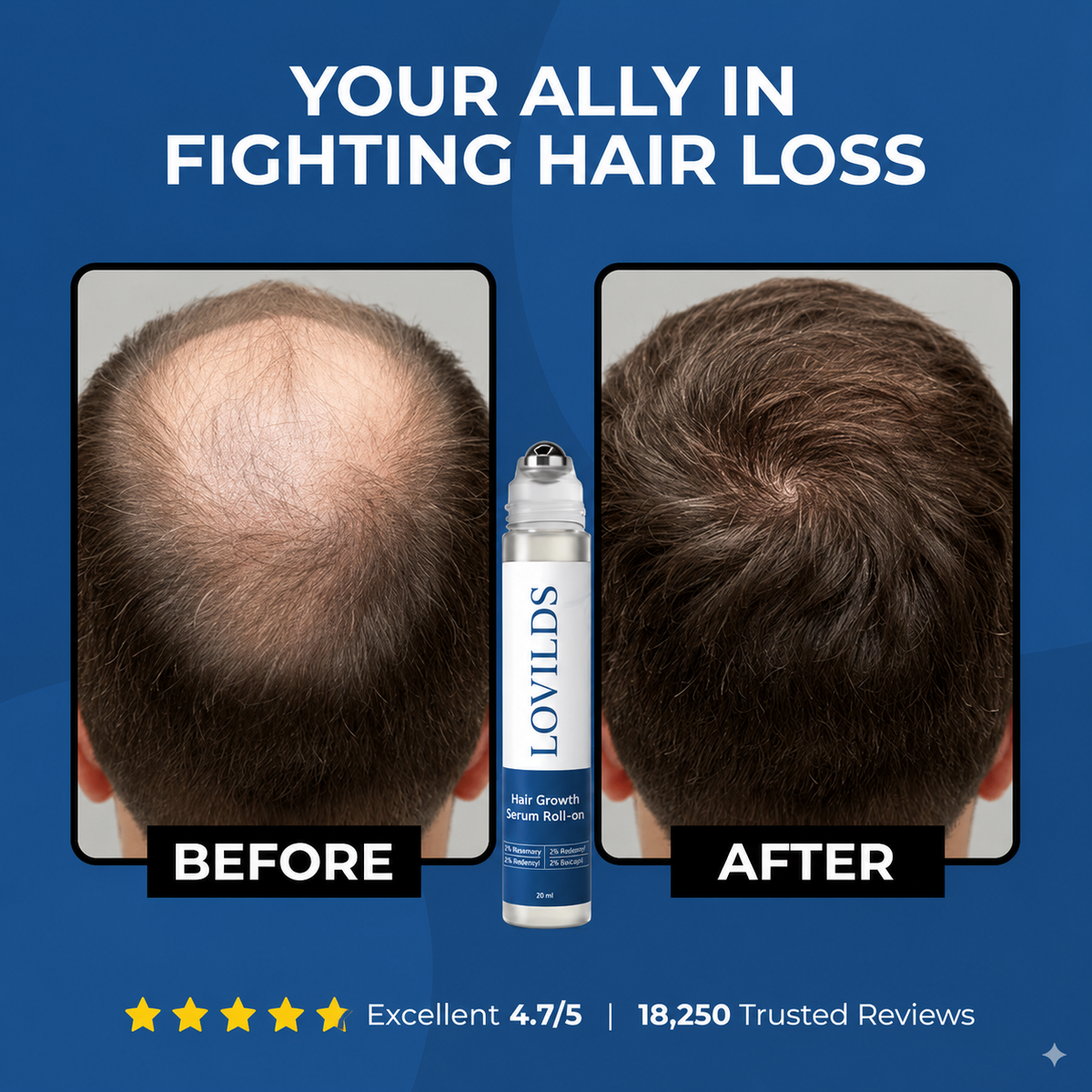 Hair Growth Roll-On Serum — Combat Thinning & Promote Thicker, Fuller Hair（Discount）