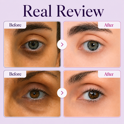 ✨ LAST DAY BUY 1 GET 1 FREE✨   Brightening Eye Cream for Dark Circles & Fine Lines