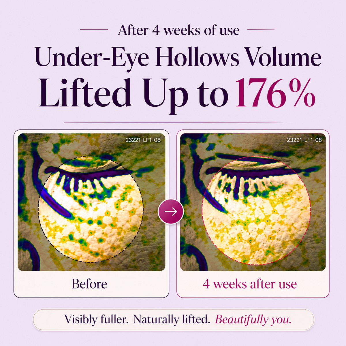 ✨ LAST DAY BUY 1 GET 1 FREE✨   Brightening Eye Cream for Dark Circles & Fine Lines