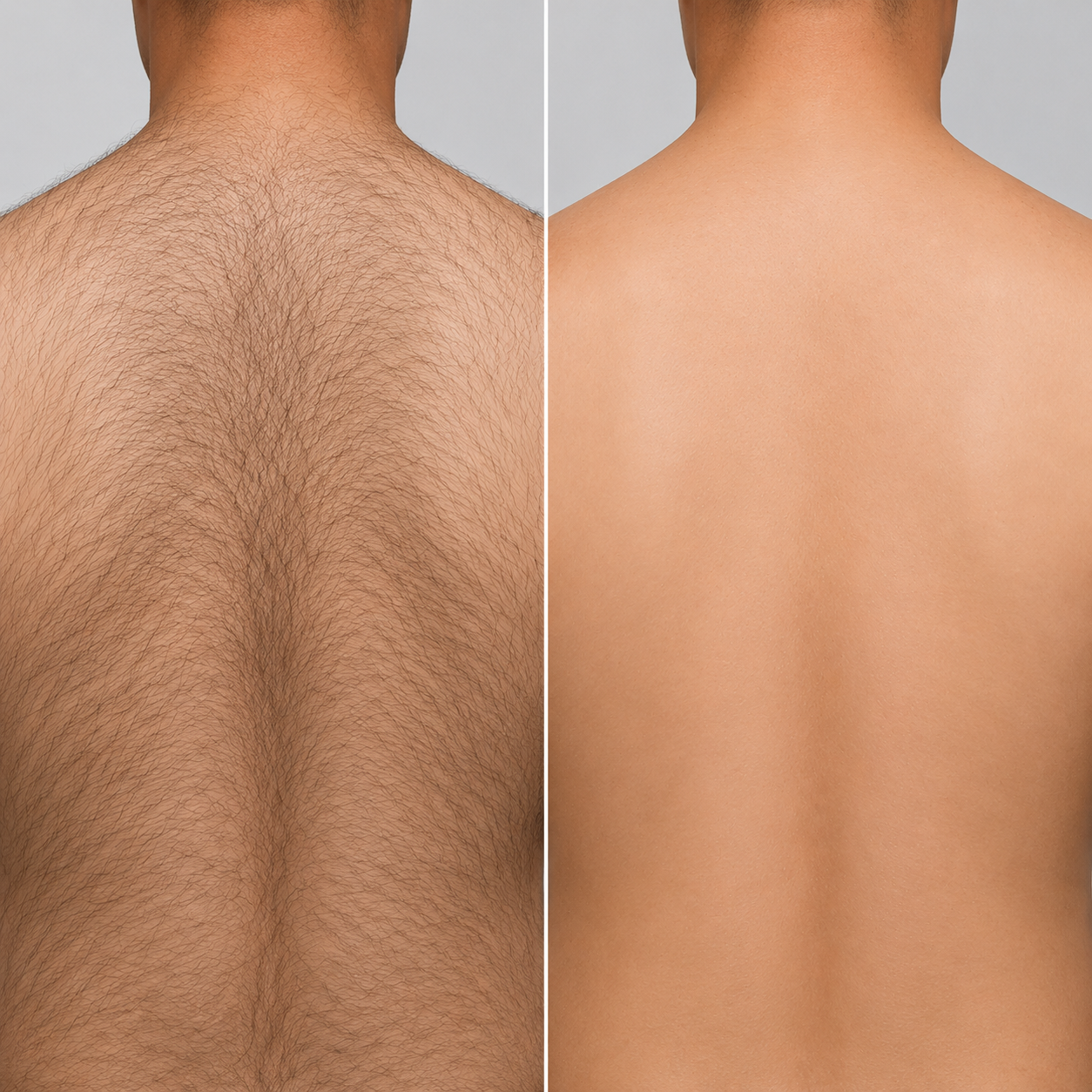 Before and after hair removal result